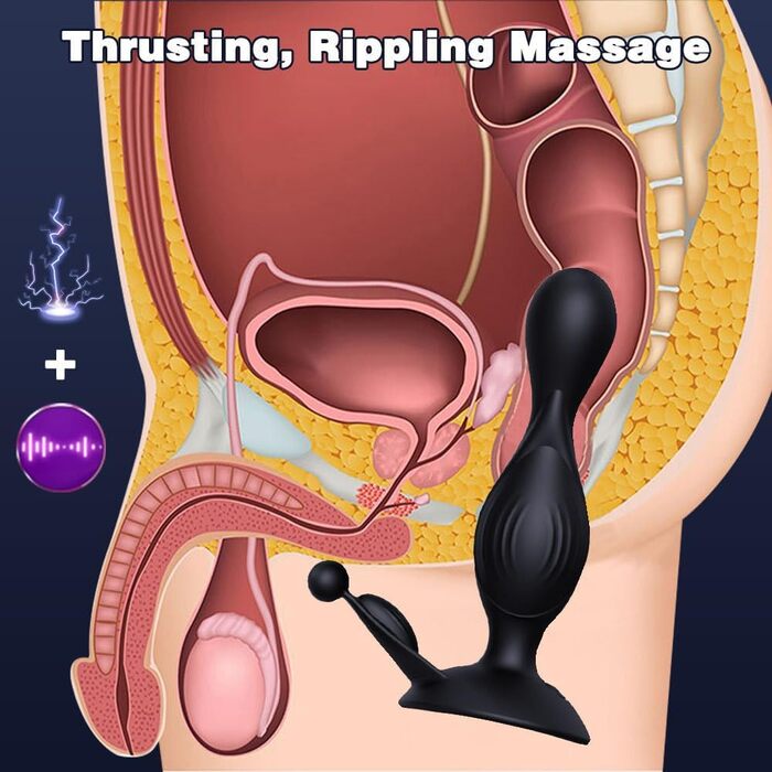 Анаlvibrator Jpscor Elektro Shock для чоловіків, стимуляція простати, 10 режимів вібрації та 5 режимів електростимуляції, дистанційне керування