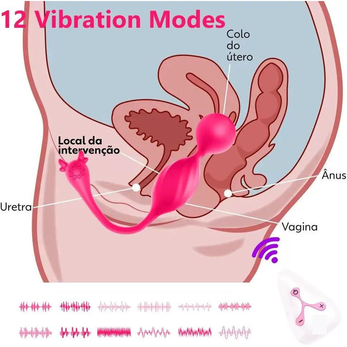 Електричний масажер для вагіни з силікону з пультом дистанційного керування, 12 режимів вібрації, тренувальний пристрій для жінок